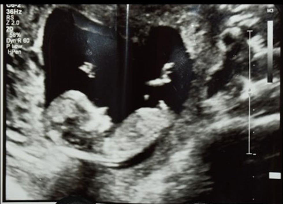 En la escena del crimen, los investigadores encontraon un casquillo y una imagen de...