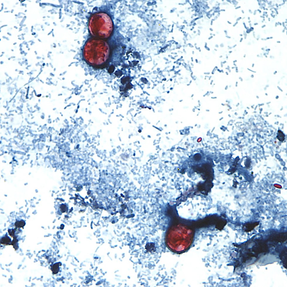 En esta imagen sin fecha, tomada a través de un microscopio y proporcionada por los Centros...